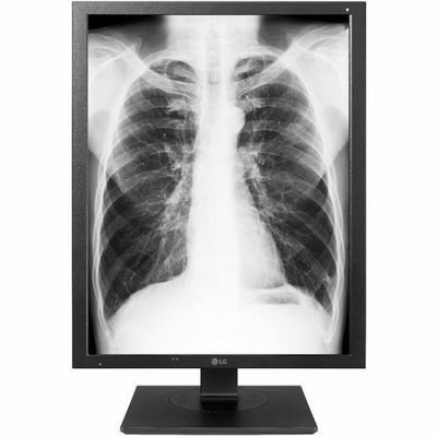 21IN 3MP LG MEDICAL DIAGNOSTIC BLACK