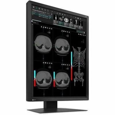 MX-SERIES21.3IN LCD LED COLOR DICOM CALIB BLK INTEG FRONT SENSOR