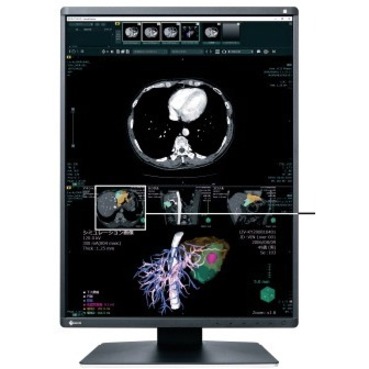 EIZO RadiForce RX370-BK 21" Class QXGA LCD Monitor - 3:4 - Black - Thumbnail 3