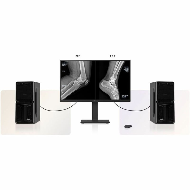 27IN 8MP CLINICAL MONITOR BLACK - Thumbnail 3