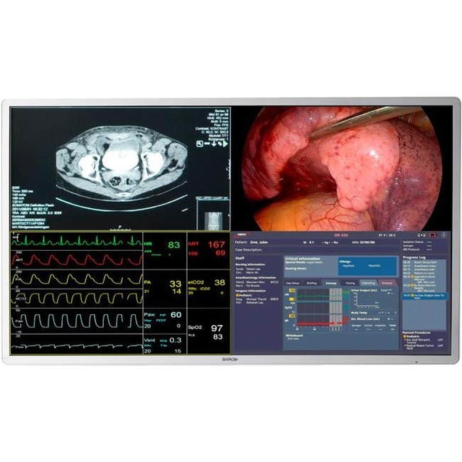 Barco MDSC-8255 LED 55" Class 4K UHD LCD Monitor - 16:9 - Thumbnail 1