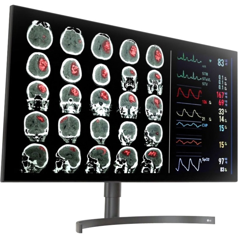 LG 32HL512D-B 32" Class 4K LCD Monitor - 16:9 - TAA Compliant - Thumbnail 5