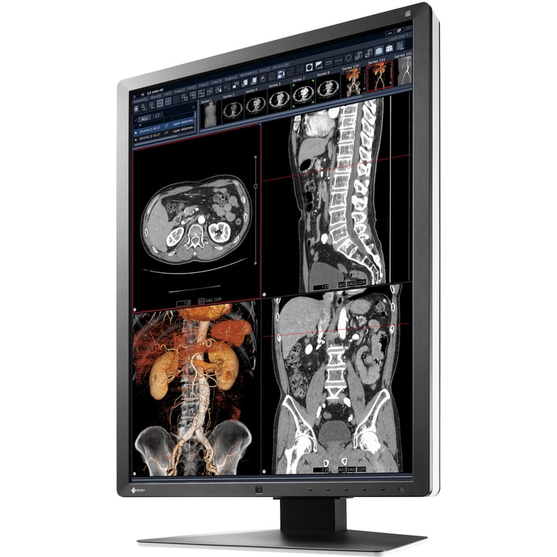 EIZO RadiForce RX250 22" Class LCD Monitor - 3:4 - Black - Thumbnail 1