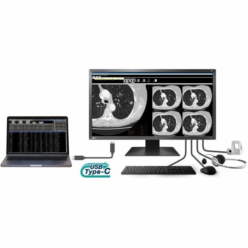 MX-SERIES 30.5IN LCD LED COLOR DICOM CALIB BLK INTEG FRONT SENSOR - Thumbnail 2