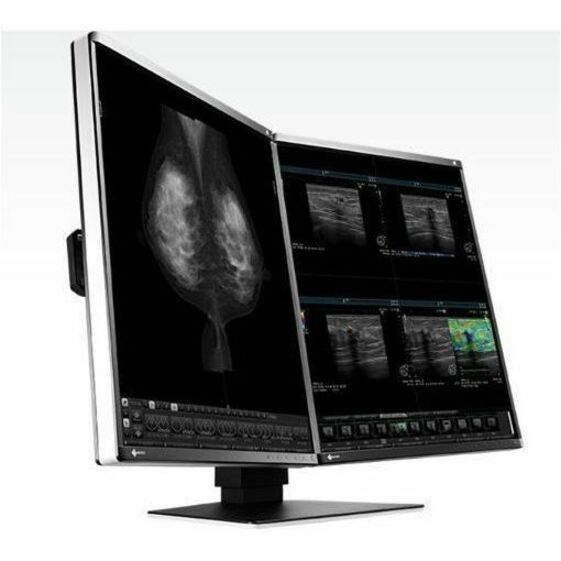 RADIFORCE 5MP 21.3 LCD LED COLOR INTEGRATED FRONT SENSOR
