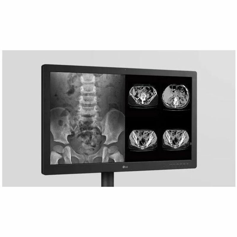 LG 32HQ713D-B 32" Class 4K UHD LCD Monitor - 16:9 - Matte Black - TAA Compliant - Thumbnail 3