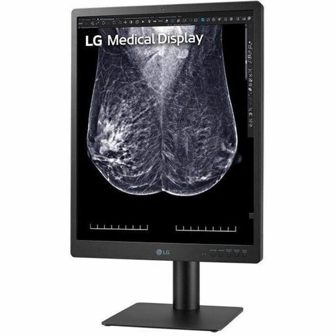21 MED 5MP DIAGNOSTICS MNT TAA2048X2560 FDA 501K CLASS II - Thumbnail 2