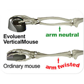 Evoluent VerticalMouse 4 Small Mouse - Thumbnail 2