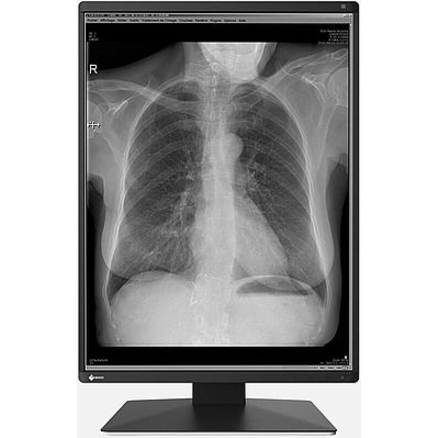 EIZO RadiForce RX250 22" Class LCD Monitor - 3:4 - Black - Thumbnail 2