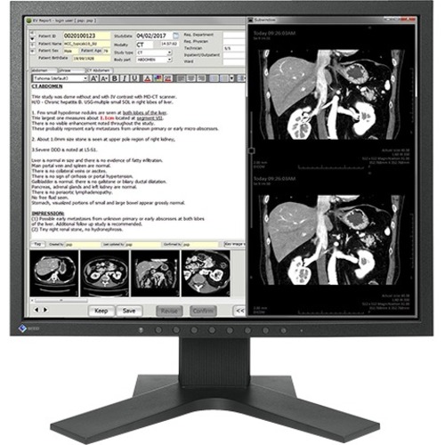 EIZO RadiForce MX194 SXGA LCD Monitor - 5:4 - Black - Thumbnail 1