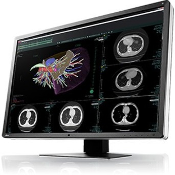 EIZO RadiForce RX660-BK 30" Class WQSXGA LCD Monitor - 16:10 - Black, White - Thumbnail 5