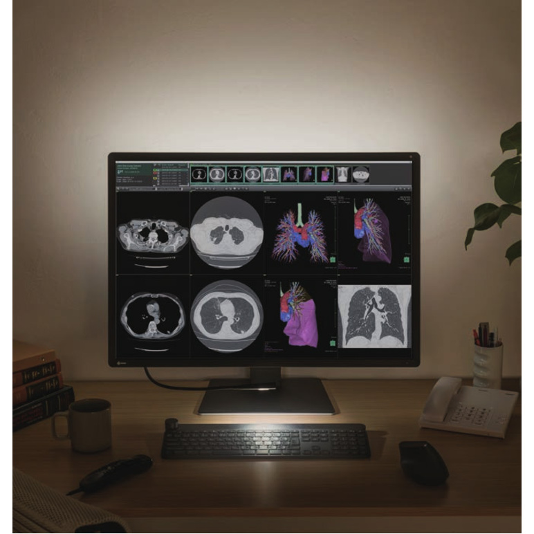EIZO RadiForce RX1270 31" Class LCD Monitor - 3:2 - Black - Thumbnail 5