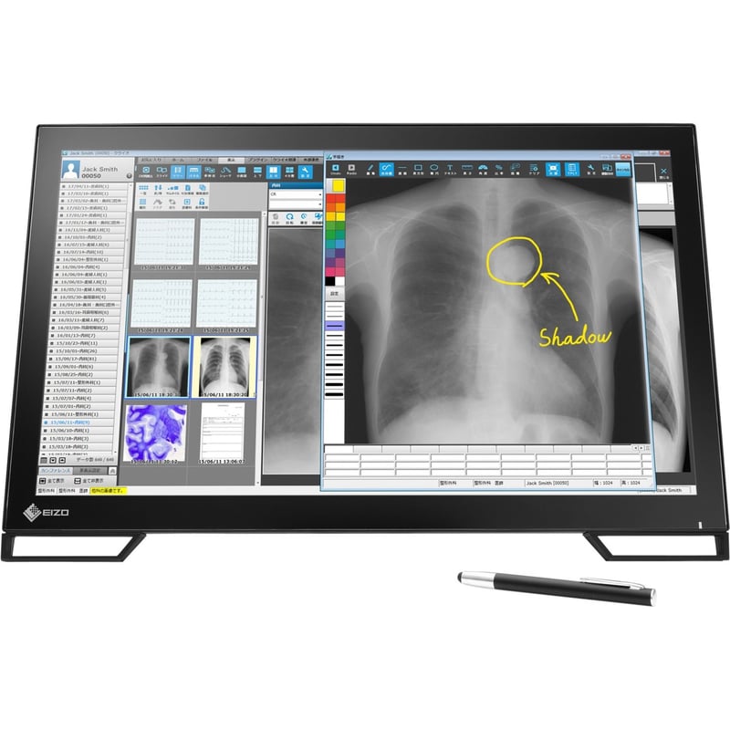 EIZO RadiForce MS236WT-A 23" Class LED Touchscreen Monitor - 16:9 - 11 ms - Thumbnail 1