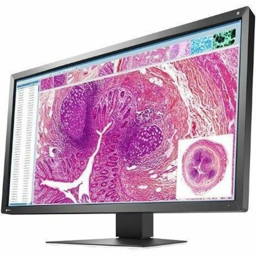 MX-SERIES 30.5IN LCD LED COLOR DICOM CALIB BLK INTEG FRONT SENSOR - Thumbnail 1