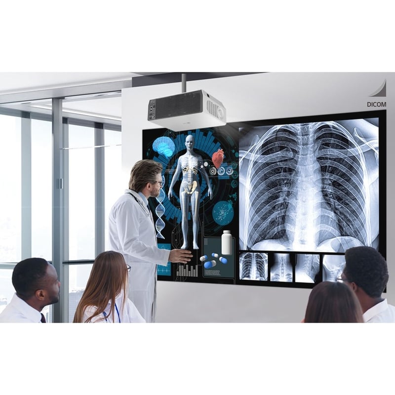 LG ProBeam GRU510N DLP Projector - 16:9 - Thumbnail 5
