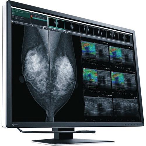 EIZO RadiForce RX1270 31" Class LCD Monitor - 3:2 - Black - Thumbnail 1