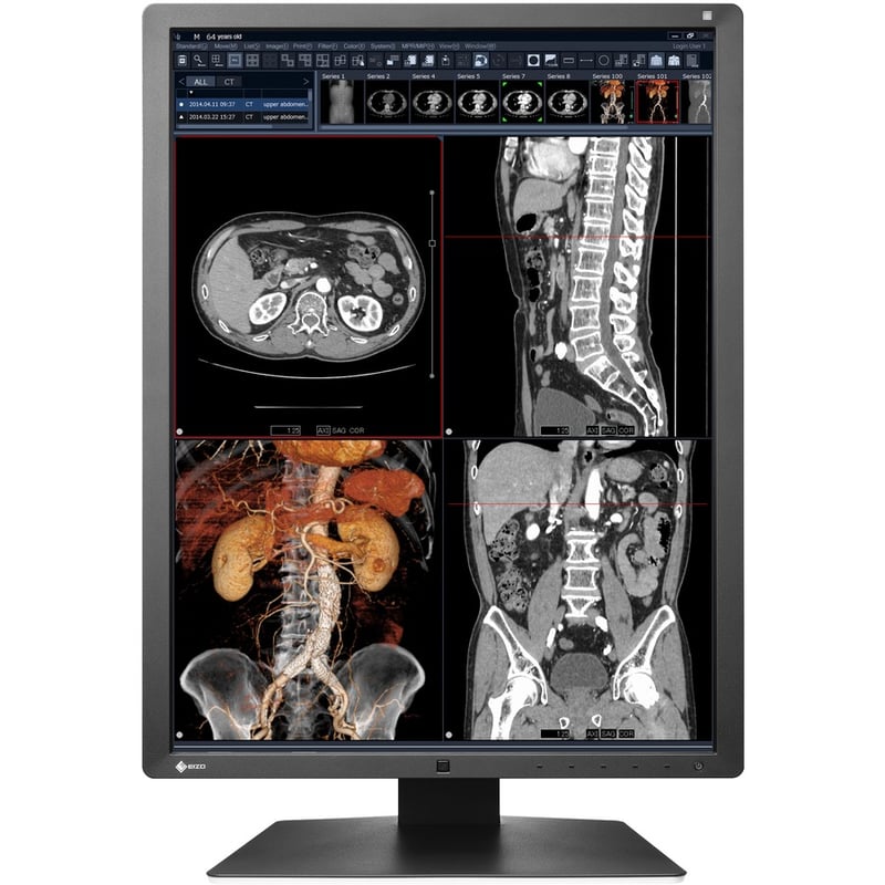 EIZO RadiForce RX250 22" Class LCD Monitor - 3:4 - Black - Thumbnail 3