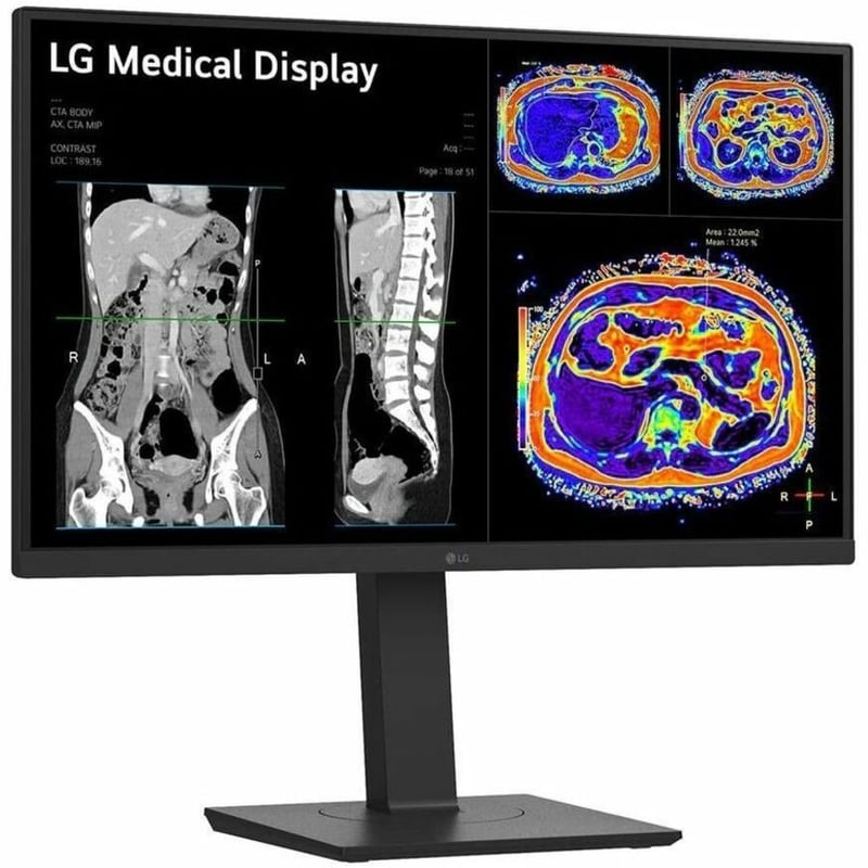 27IN 8MP CLINICAL MONITOR BLACK - Thumbnail 1