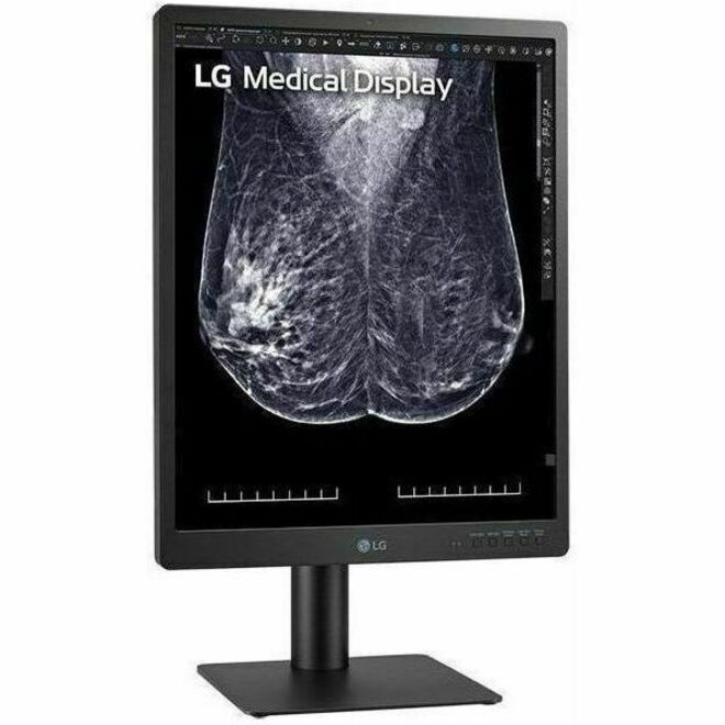 21 MED 5MP DIAGNOSTICS MNT TAA2048X2560 FDA 501K CLASS II - Thumbnail 5