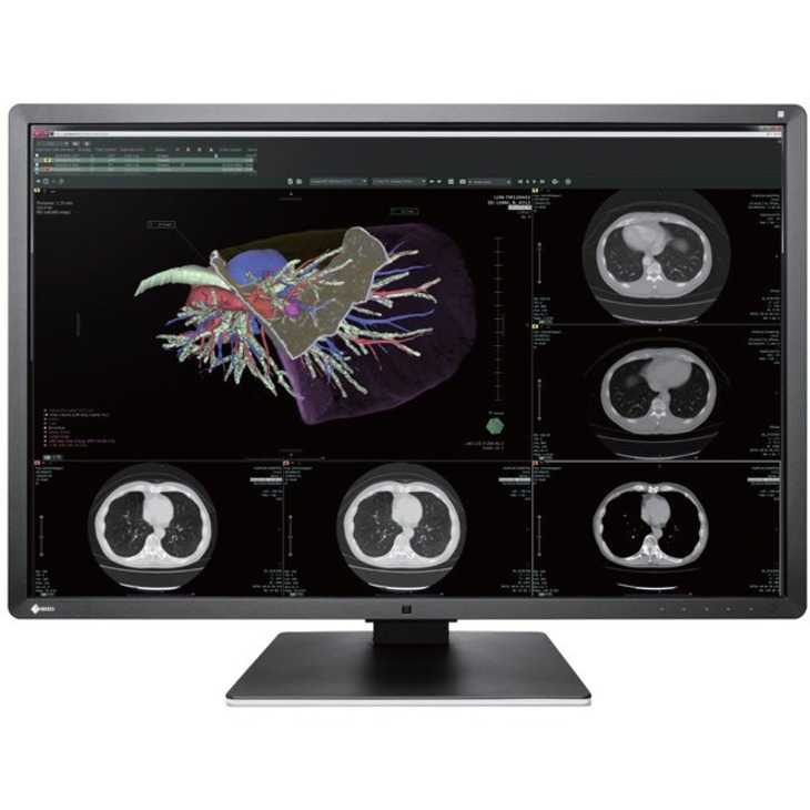 EIZO RadiForce RX660-BK 30" Class WQSXGA LCD Monitor - 16:10 - Black, White - Thumbnail 4