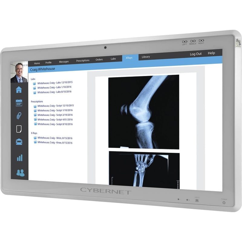 Cybernet CYBERMED-XB24 24" Class LCD Touchscreen Monitor - 16:9 - Thumbnail 5