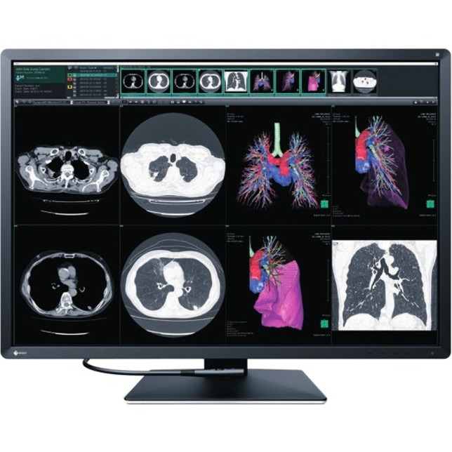 EIZO RadiForce RX1270 31" Class LCD Monitor - 3:2 - Black - Thumbnail 3