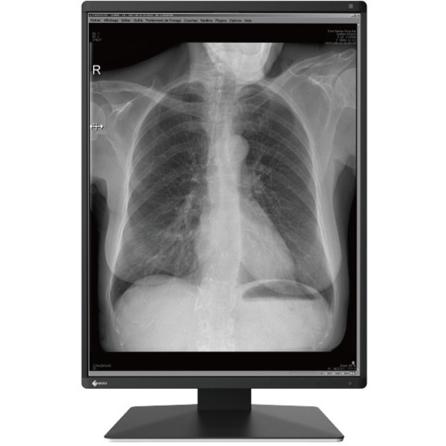 EIZO RadiForce RX370-BK 21" Class QXGA LCD Monitor - 3:4 - Black - Thumbnail 5